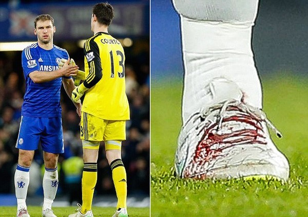 Đôi giày Ivanovic loang lổ máu trong trận đấu với Liverpool ở League Cup.