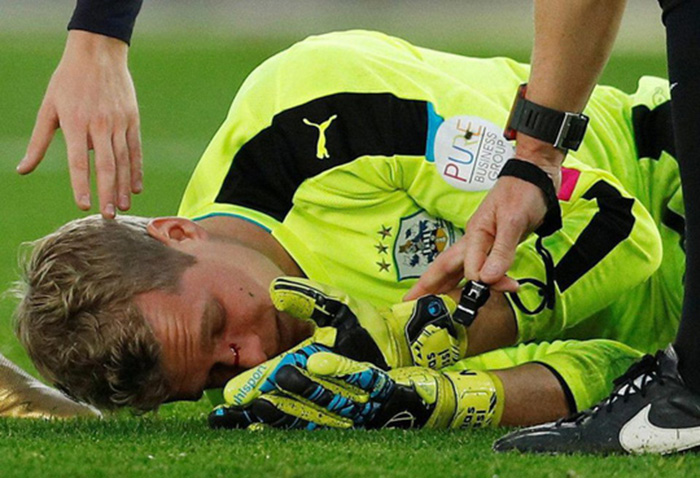 Thủ môn của Huddersfield chảy máu mũi sau cú đạp của Austin.