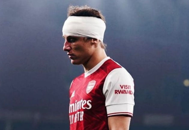 Arsenal thua trận thứ 5 qua 10 vòng.