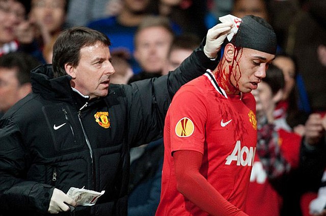 Smalling từng đổ máu vì màu áo đỏ. Ảnh: Internet.