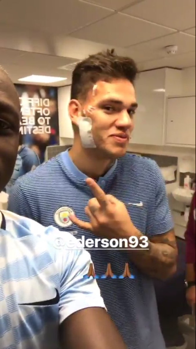 Bức ảnh mới nhất về tình trạng của Ederson.