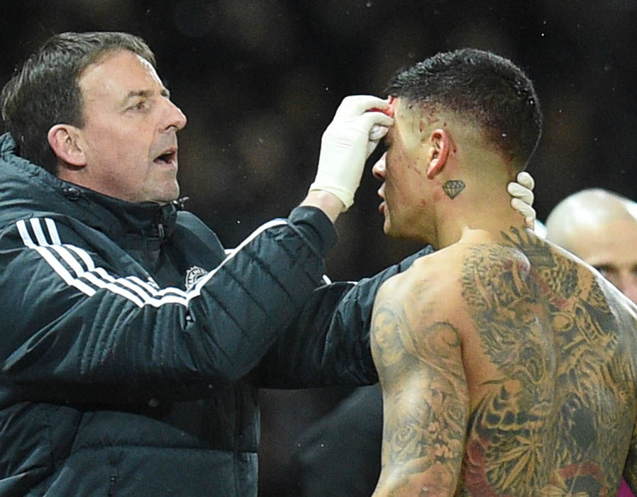 Sau sự chăm sóc của các bác sĩ, Rojo đã thi đấu tiếp tục.