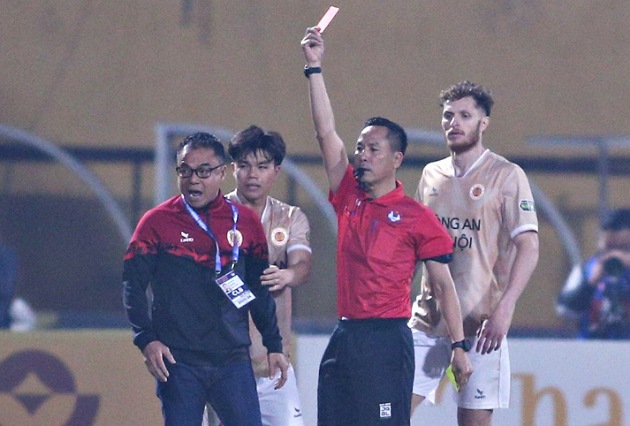 8 cầu thủ ĐT Việt Nam chấn thương; Kiatisuk nói lời cay đắng cùng HAGL - Bóng Đá