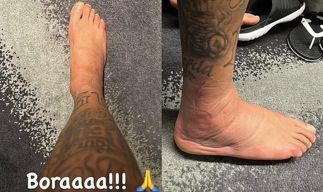 Neymar đăng ảnh kinh dị về chấn thương - Bóng Đá