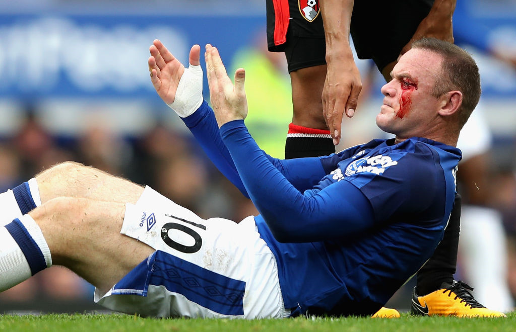 Dính cùi chỏ, Rooney thi đấu với gương mặt sưng húp, bê bết máu - Bóng Đá