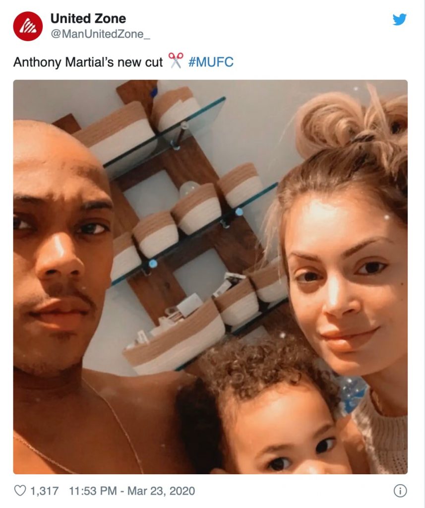 Man Utd star Anthony Martial baffles fans with bold new look - Bóng Đá