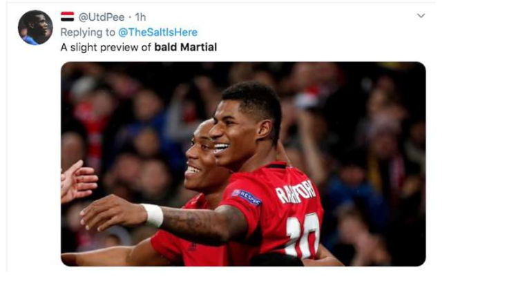 Man Utd star Anthony Martial baffles fans with bold new look - Bóng Đá