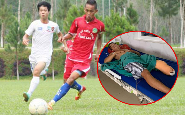Cựu đội trưởng Đắk Lắk gặp tai nạn kinh hoàng, phải cưa chân để giữ lại mạng sống - Bóng Đá