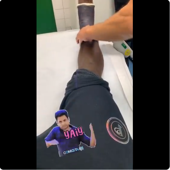 Pogba đăng video tháo bột bàn chân trên instagram - Bóng Đá