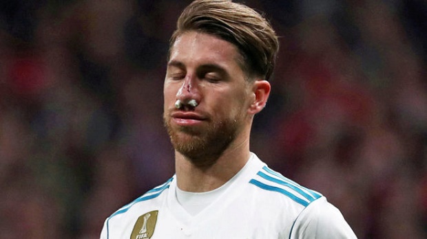 Cập nhật tình hình chấn thương mũi của Sergio Ramos - Bóng Đá
