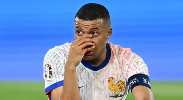 Ảnh bài viết Tất tần tật tình huống Mbappe gãy mũi