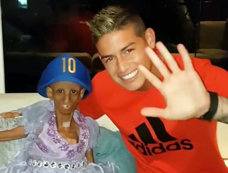 James Rodriguez hoàn thành giấc mơ của cô bé tuổi teen mắc bệnh hiểm nghèo