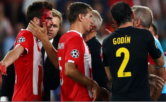 Atletico Madrid thắng nhẹ trên đất Hà Lan
