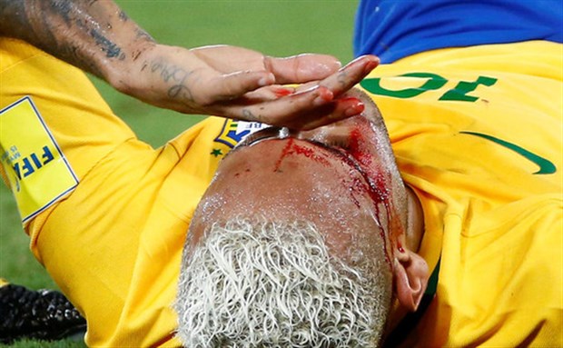 Chùm ảnh: Neymar chảy máu lênh láng trong chiến thắng '5 sao' của Brazil
