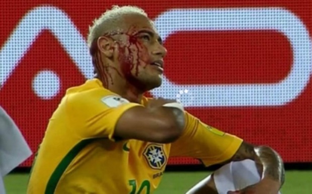 Ảnh bài viết Rùng rợn những pha bóng đầy 'bạo lực' trên sân cỏ