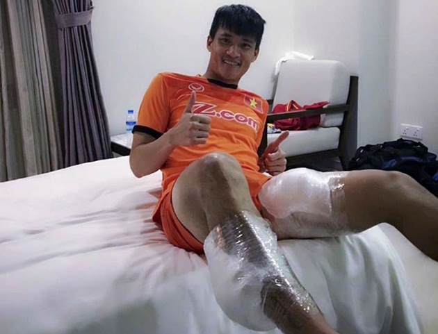 Ảnh bài viết Hậu chiến thắng Malaysia, Công Vinh “khoe” hai đùi... chườm đá