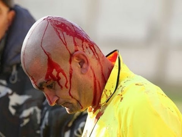 Ảnh bài viết Top 20 pha hành hung thô bạo nhất với trọng tài