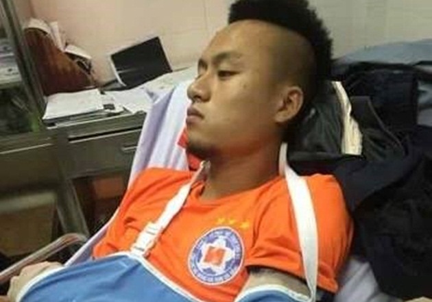 Võ Huy Toàn phải phẫu thuật 2 lần, nghỉ thi đấu 6 tháng