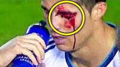 Ảnh bài viết Những lần đổ máu khó quên trong làng túc cầu