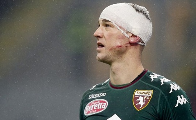 Joe Hart đổ máu vì bị gầm giày cào lên đầu