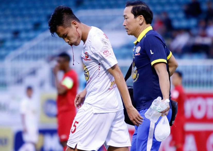 Những điểm nhấn vòng 2 V-League: Máu, nước mắt và dấu ấn trọng tài
