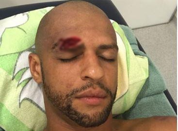 ‘Thùng rác vàng’ Brazil dính chấn thương kinh dị