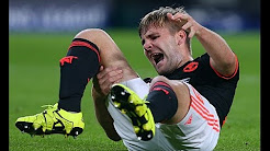 Ảnh bài viết Cận cảnh chấn thương đã thay đổi sự nghiệp của Luke Shaw