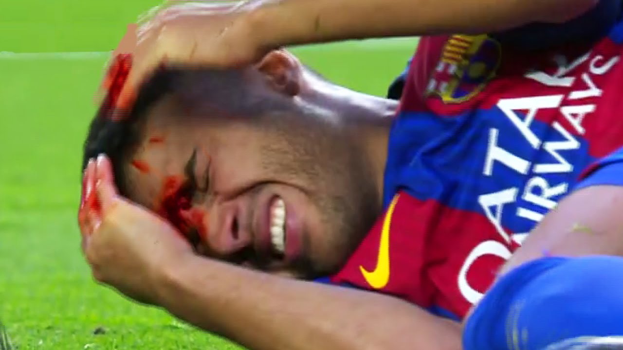 Ảnh bài viết Những tình huống va chạm kinh hoàng đầu năm 2017