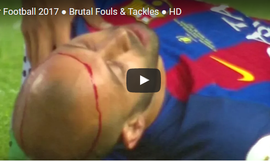 Ảnh bài viết Những pha bóng 'đẫm máu' năm 2017