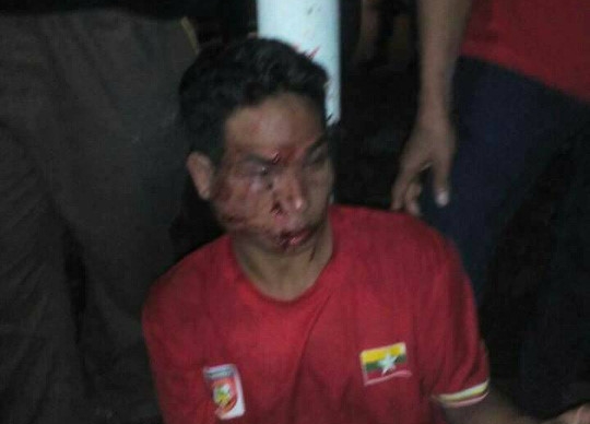 Tới Shah Alam coi đá bóng, CĐV U22 Myanmar bị đánh cho sấp mặt