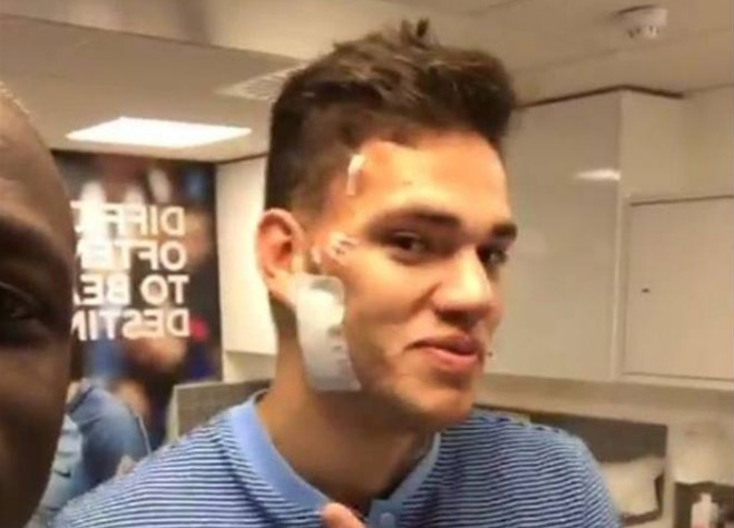 Ảnh bài viết Ederson tự tin khoe thẹo sau cú vào bóng của Mane