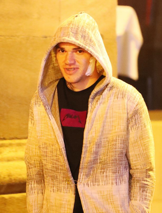 Ảnh bài viết Thủ môn Man City "tự tin khoe cá tính" sau tai nạn kinh hoàng