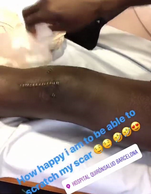 Ảnh bài viết Choáng với vết thương kinh hoàng của Benjamin Mendy