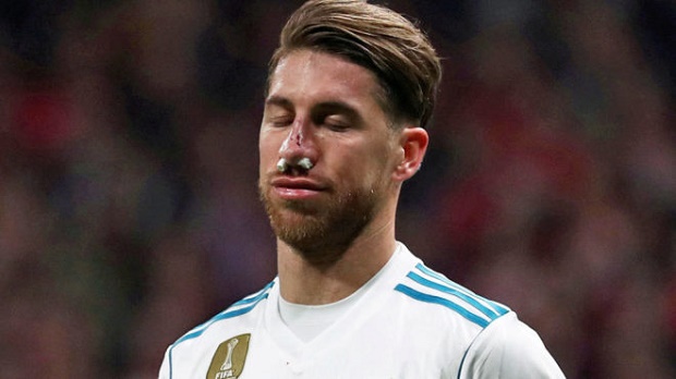 Ảnh bài viết Cập nhật tình hình chấn thương mũi của Sergio Ramos