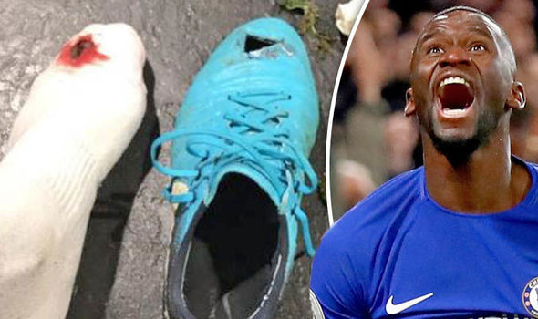 Ảnh bài viết Sao Chelsea gây sốc khi khoe ảnh máu me