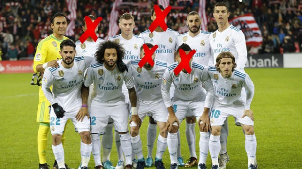 Ảnh bài viết Zidane bế tắc với bài toán 'vá' hàng phòng ngự