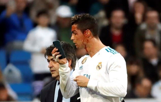 Ảnh bài viết Cực hài: Ronaldo mượn điện thoại bác sĩ soi vết thương