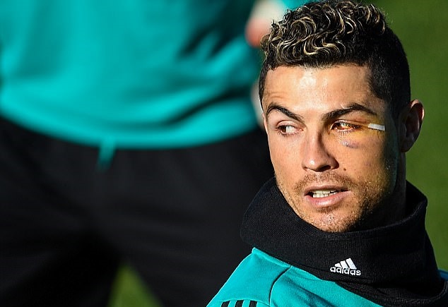 Ảnh bài viết Ronaldo tập sung dù mắt sưng húp, quyết cứu nguy Real Madrid