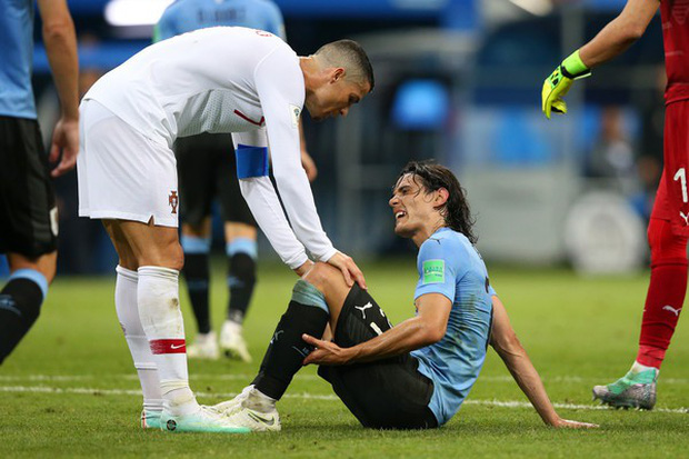 Cavani đi khập khiễng, dễ nghỉ đá trận gặp Pháp