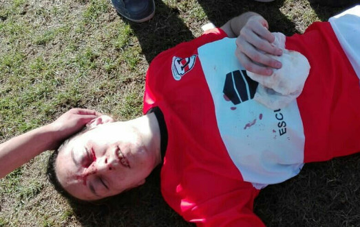 Ảnh bài viết 4 cầu thủ nữ nhập viện sau cuộc hỗn chiến trên sân