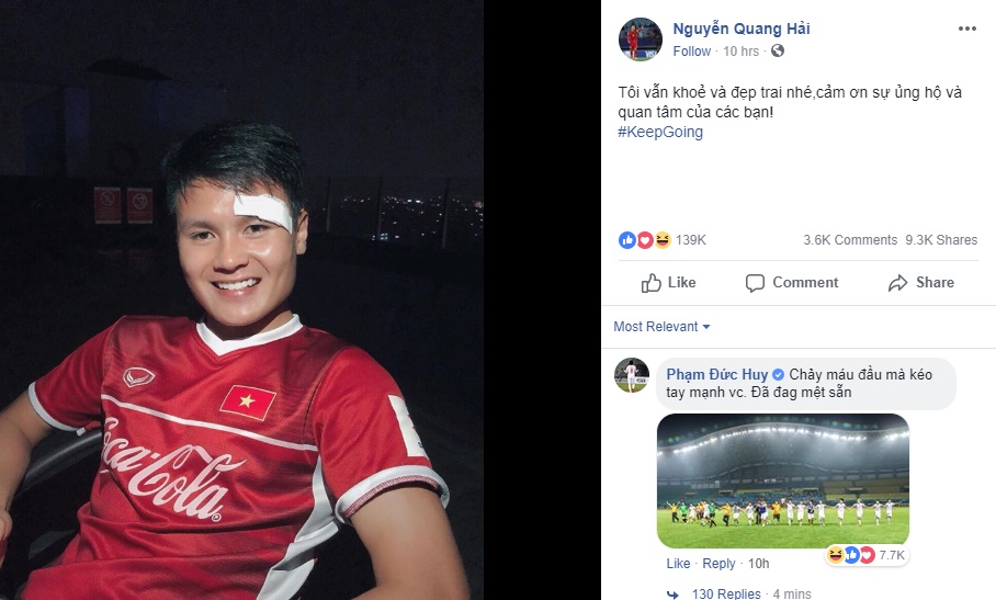 Ảnh bài viết Đổ máu, rách mí mắt và đây là câu trả lời của Quang Hải