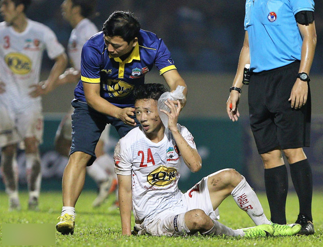 Ảnh bài viết HAGL nhận hung tin lực lượng trước ngày khai màn V-League 2019