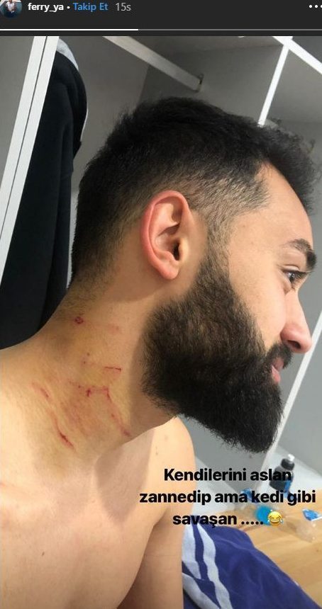 Ảnh bài viết Sốc: Cầu thủ bị đối thủ dùng dao cứa cổ ngay trên sân