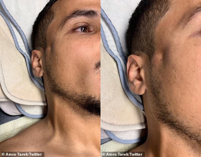 Kinh dị! Ibrahimovic thúc cùi chỏ... gây lõm mặt, vỡ xương đối thủ
