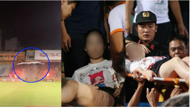 Báo châu Á nói 1 điều về sự cố pháo sáng gây thương tích ở Hàng Đẫy