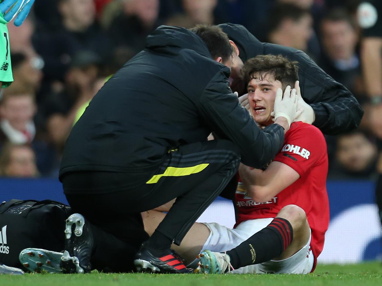 Ảnh bài viết Đổ máu ở OTF, Daniel James suýt bất tỉnh nhưng đích thị mang DNA Quỷ đỏ