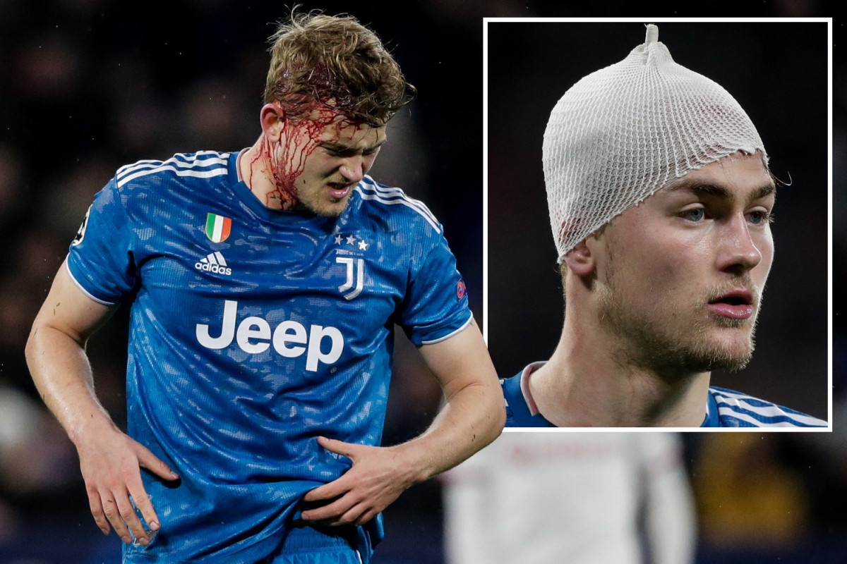 Ảnh bài viết Cận cảnh va chạm kinh hoàng khiến De Ligt đổ máu xối xả