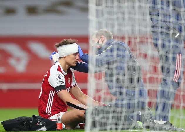 SỐC! Sao Arsenal băng đầu thi đấu, Arteta bị tố 'vô nhân đạo'