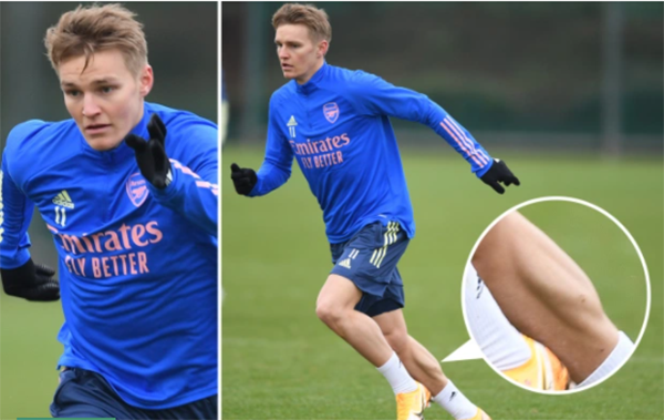 Ảnh bài viết Chỉ với 1 bức ảnh, Odegaard chứng tỏ không hề kém cạnh Grealish