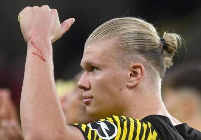 Lý do Haaland và Reus vắng mặt ở trận thua Gladbach